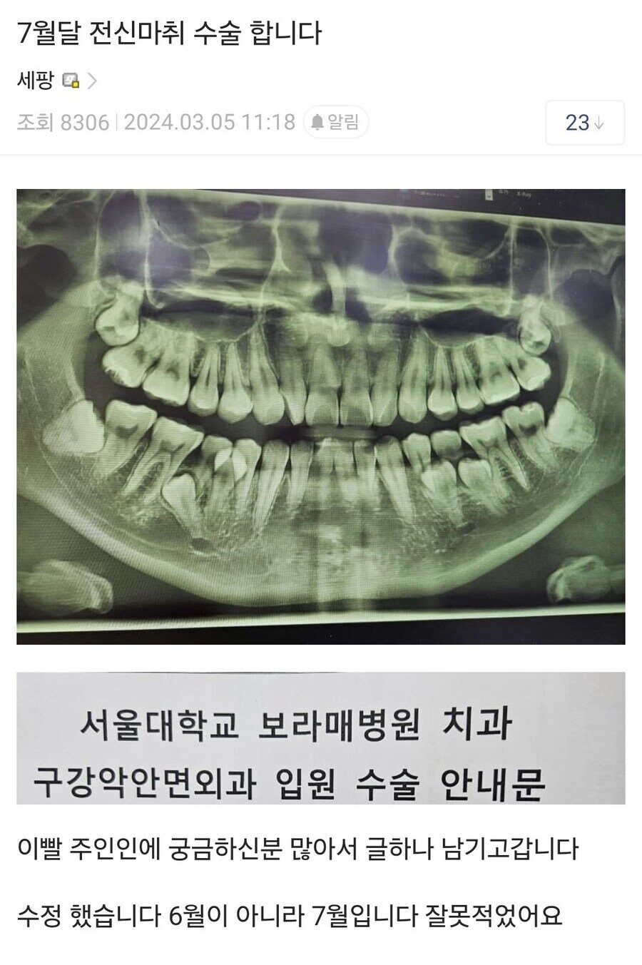 사랑니 레전드 수술 전후_3.jpg