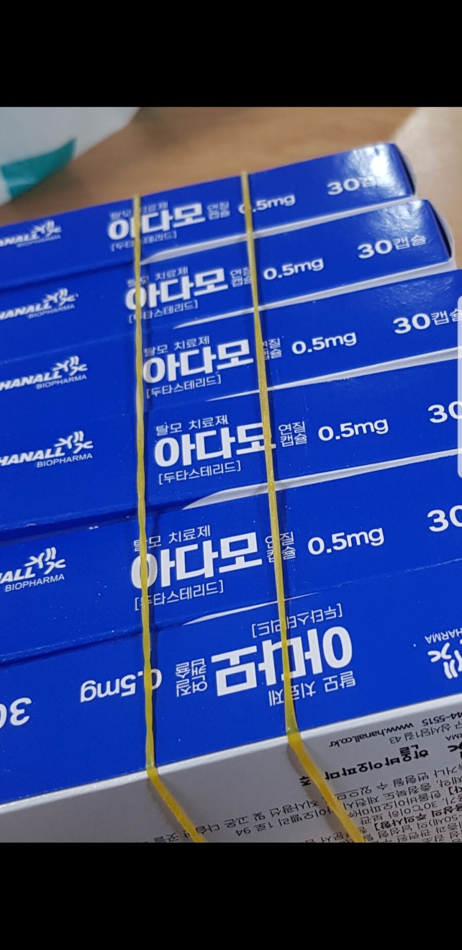 탈모 놀리는 사람들의 최후_1.jpg