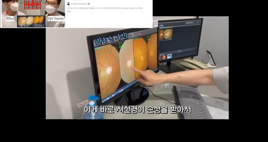 주작 해명 하는 시각 장애인 유튜버_33.jpg