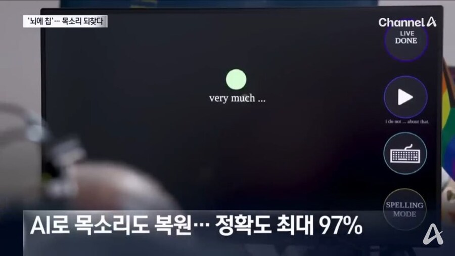 뇌 임플란트 실험 결과 근황_5.jpg