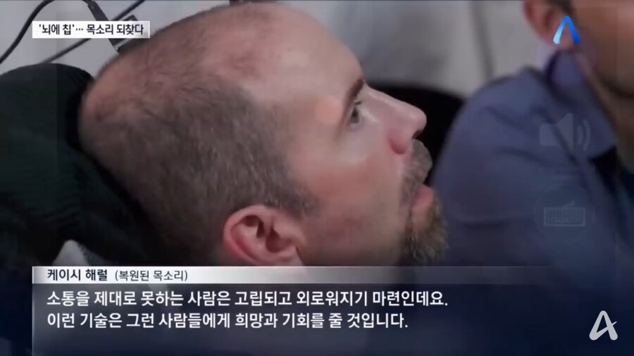 뇌 임플란트 실험 결과 근황_7.jpg