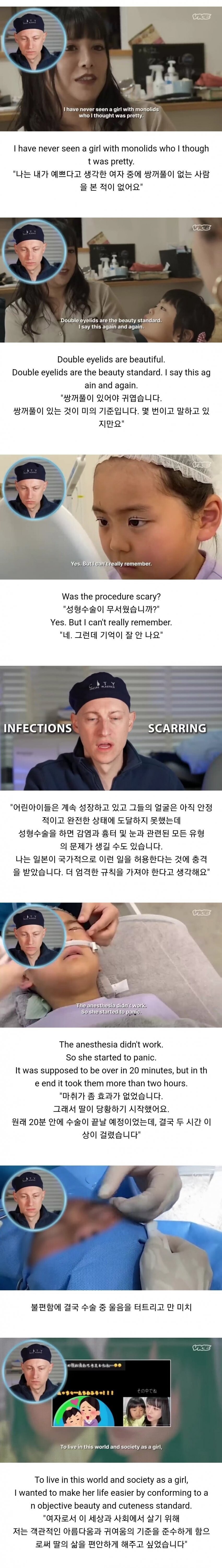 성형수술 받은 일본 초등학생.jpg_2.jpg