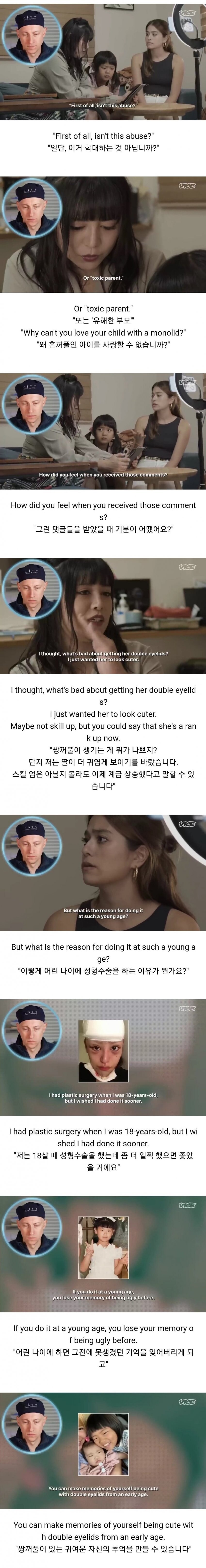 성형수술 받은 일본 초등학생.jpg_3.jpg