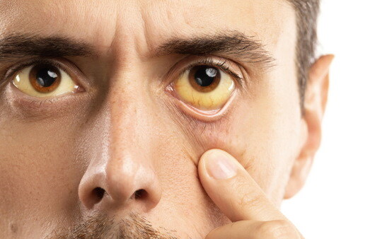 진짜 살이 쭉쭉 빠지고 있다는 신호_1.jpg