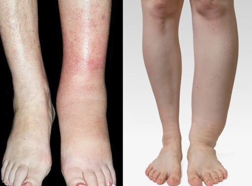 진짜 살이 쭉쭉 빠지고 있다는 신호_5.jpg