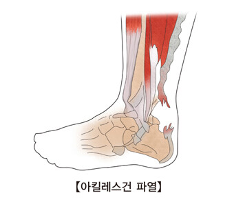 의외로 요즘 창작자들이 무시하는 것 중 하나_1.jpg