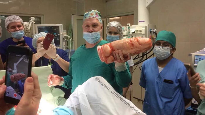 환자 몸 속에 들어있던 물건_1.jpg