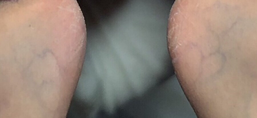 와 발에 핏줄봐...._2.jpg