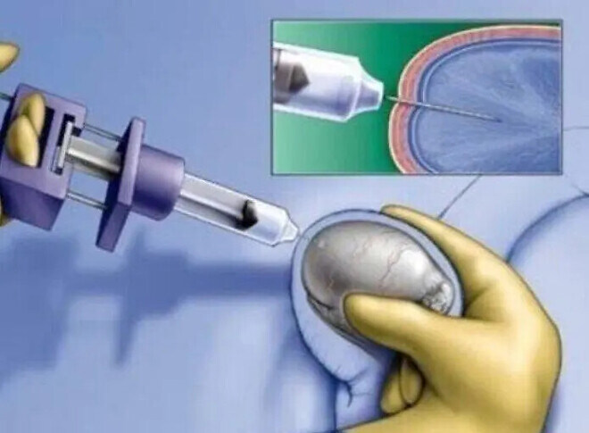 의외로 실존한다는 비뇨기과 정액검사 방법 ㄷㄷㄷ.jpg_1.jpg