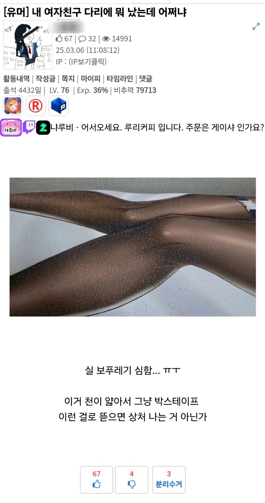 여자친구 다리에 뭐가 나서 슬픈 유게이.jpg_1.jpg