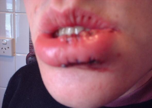 [약혐] 의외로 인터넷 역사에 한 획을 그은 사진.jpg_1.jpg