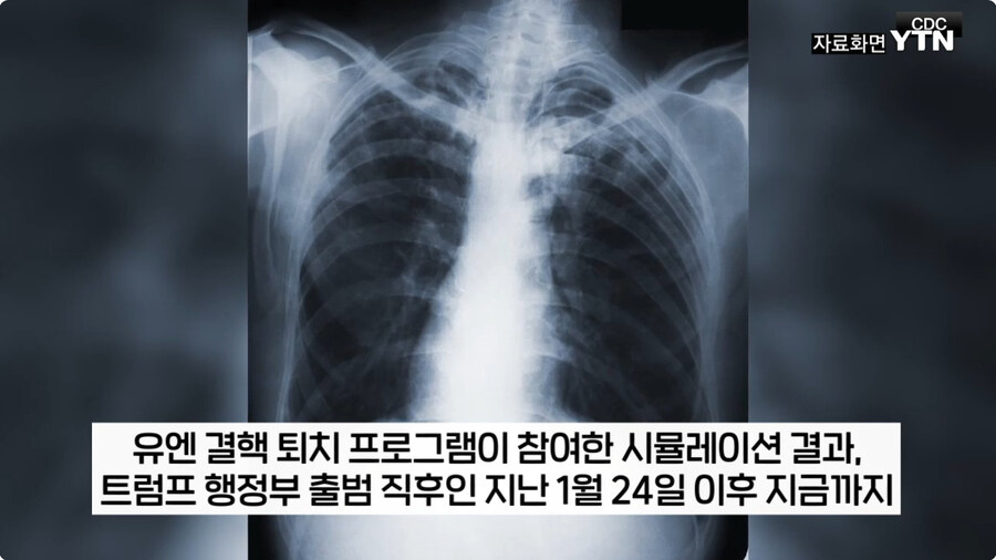 도람푸랑 머스크가 낭비라고 생각하면서 죽여버린거_4.jpg