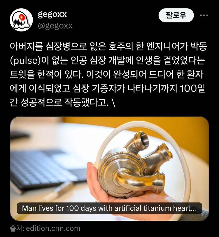 심장병으로 아버지를 잃은 엔지니어가 만든 박동 없는 티타늄 심장.jpg_1.jpg