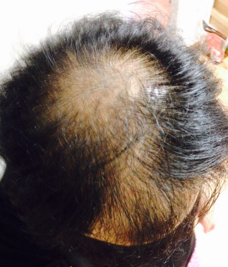 고양이는 털이 수천가닥이 빠져도 멋진 모피를 유지 하는데_3.jpg