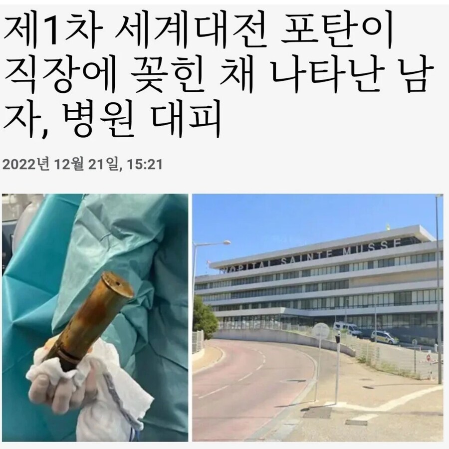 1차 세계대전 포탄이 항문에 꽂힌 채 나타난 남자, 병원 대피_1.png