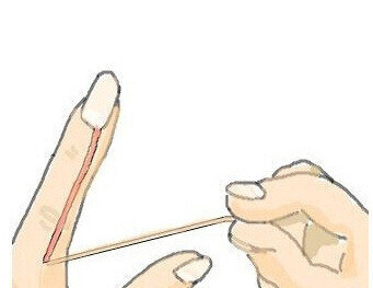 혐 ) 전설의 천하장사 소세지 벗겨 먹는 짤 ㄹㅇ ㅋㅋ_1.jpg