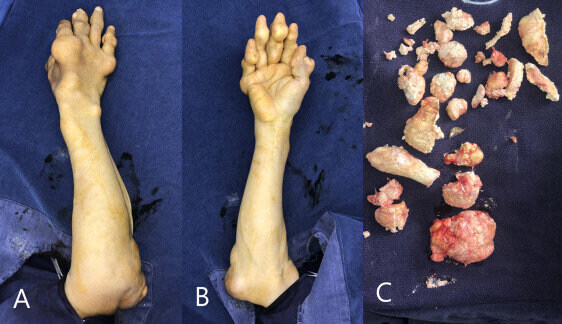 통풍 짤 종합 세트_2.jpg