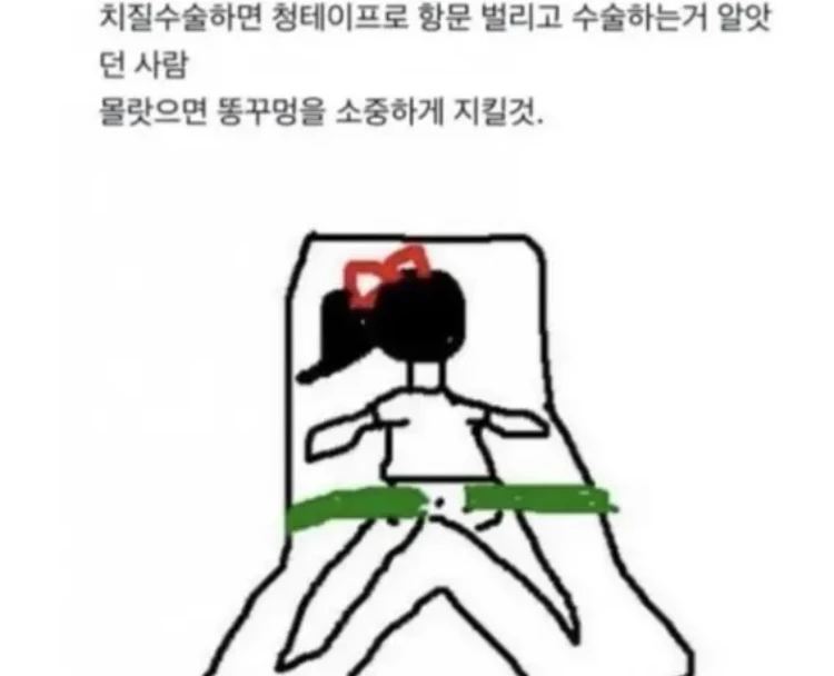 항문을 소중히 대해야 하는 이유_1.webp