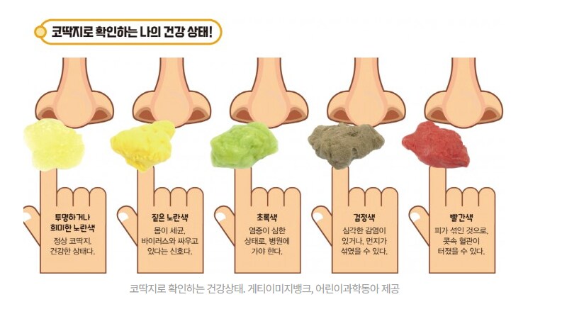 코딱지로 확인하는 건강 상태_1.png