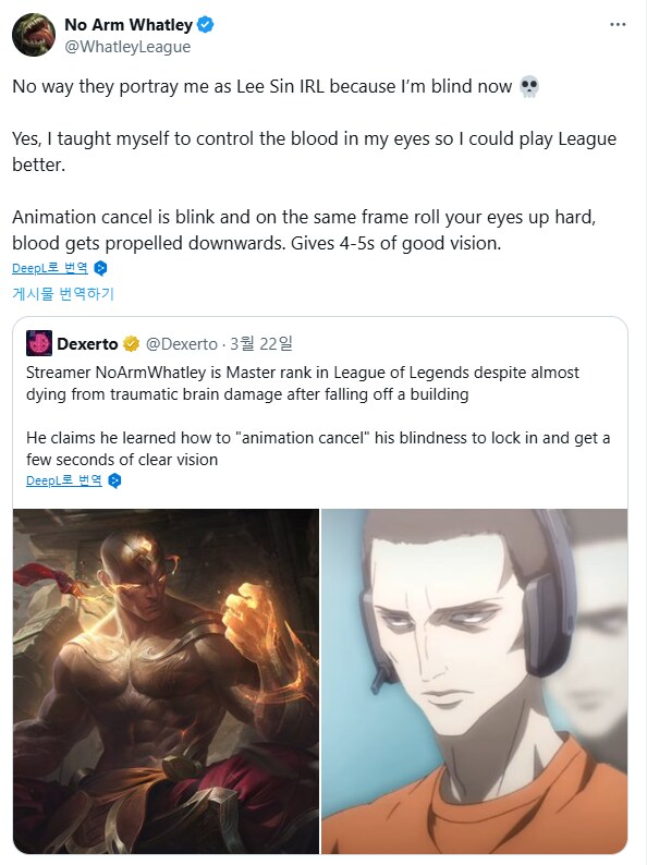뇌 수술 후 실명한 스트리머가 롤 마스터 복귀함_4.png