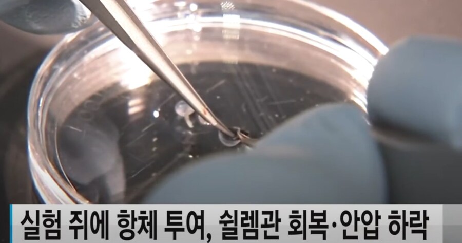 의학 분야의 신기술 개발 뉴스는 걸러들어야 하는 이유_3.jpg