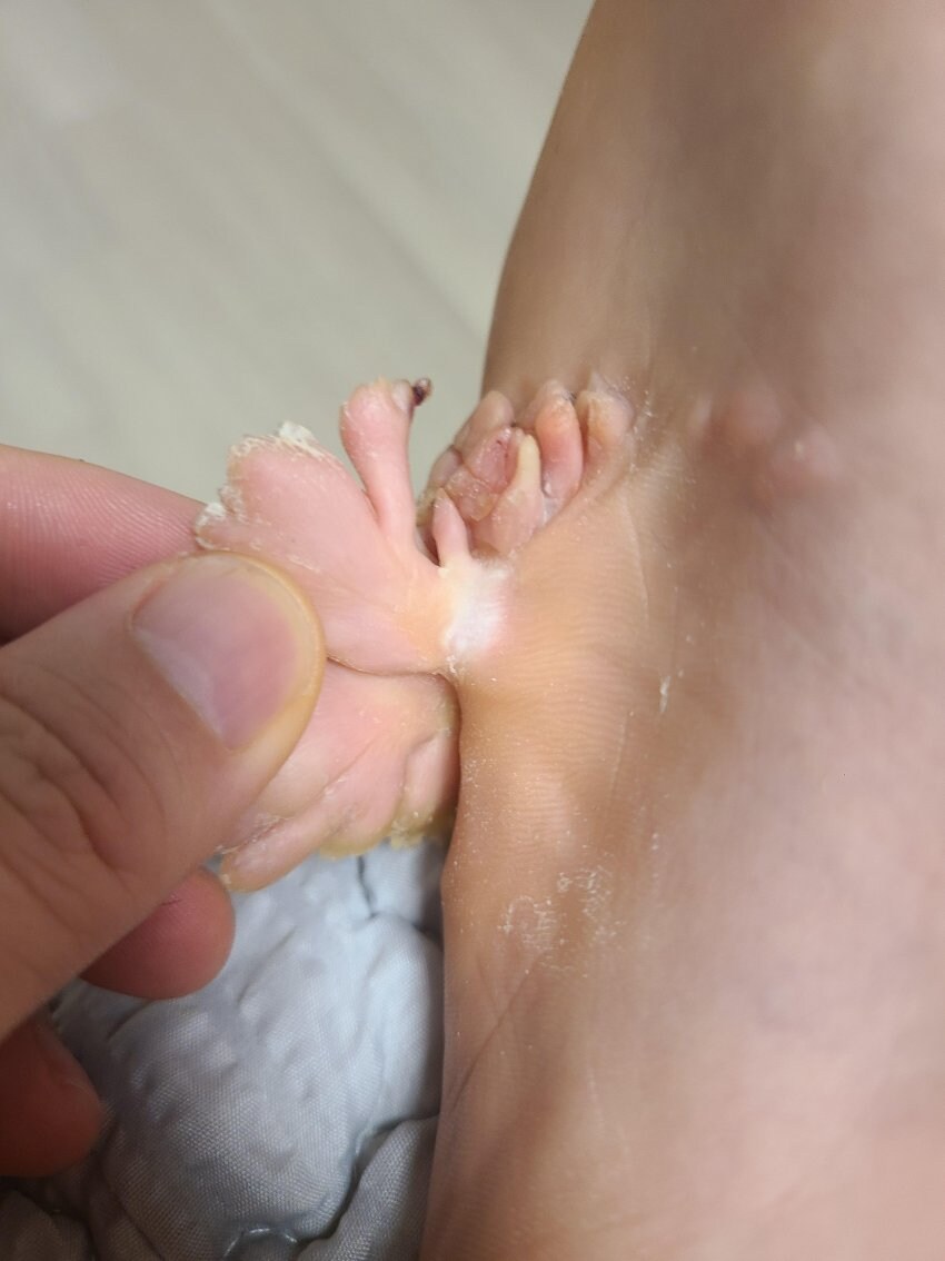 혐)아침부터 사마귀로 눈을 괴롭히다니 보답이다_3.jpg