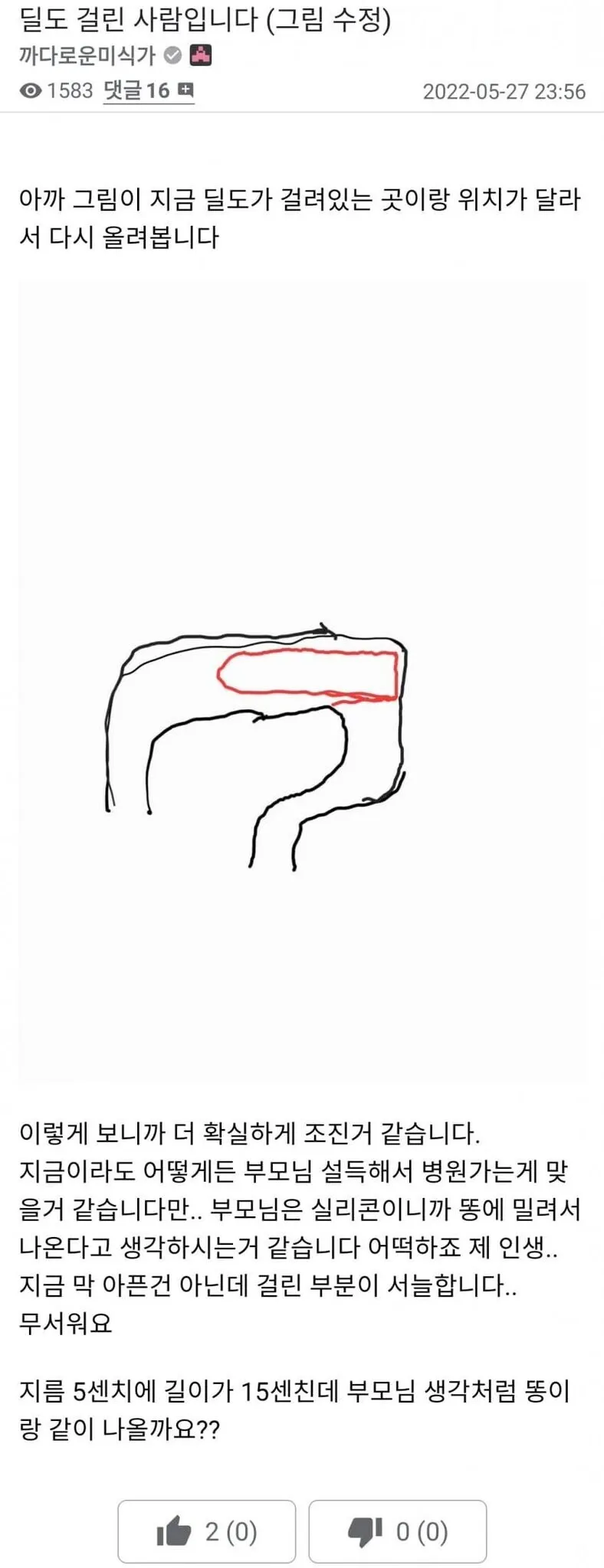 딜도가 직장에 들어가서 안나옵니다_3.webp