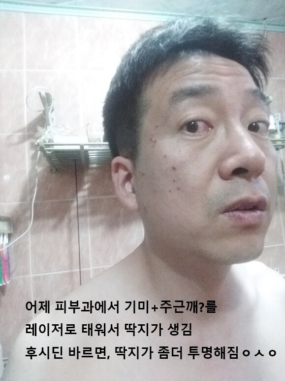 0522 운동일지: "레이저 대공세" 편_19.jpg