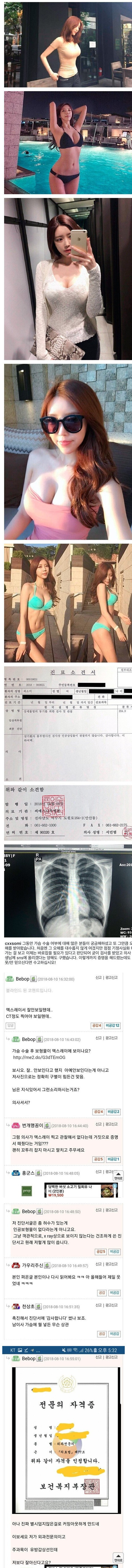 자연산 가슴을 믿지않는 사람