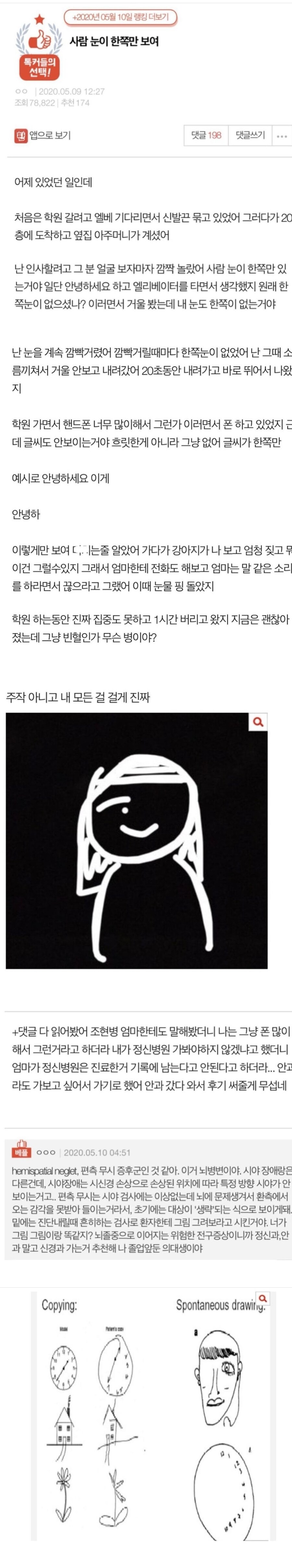 공포) 사람 눈이 한쪽만 보여.png_1.jpg