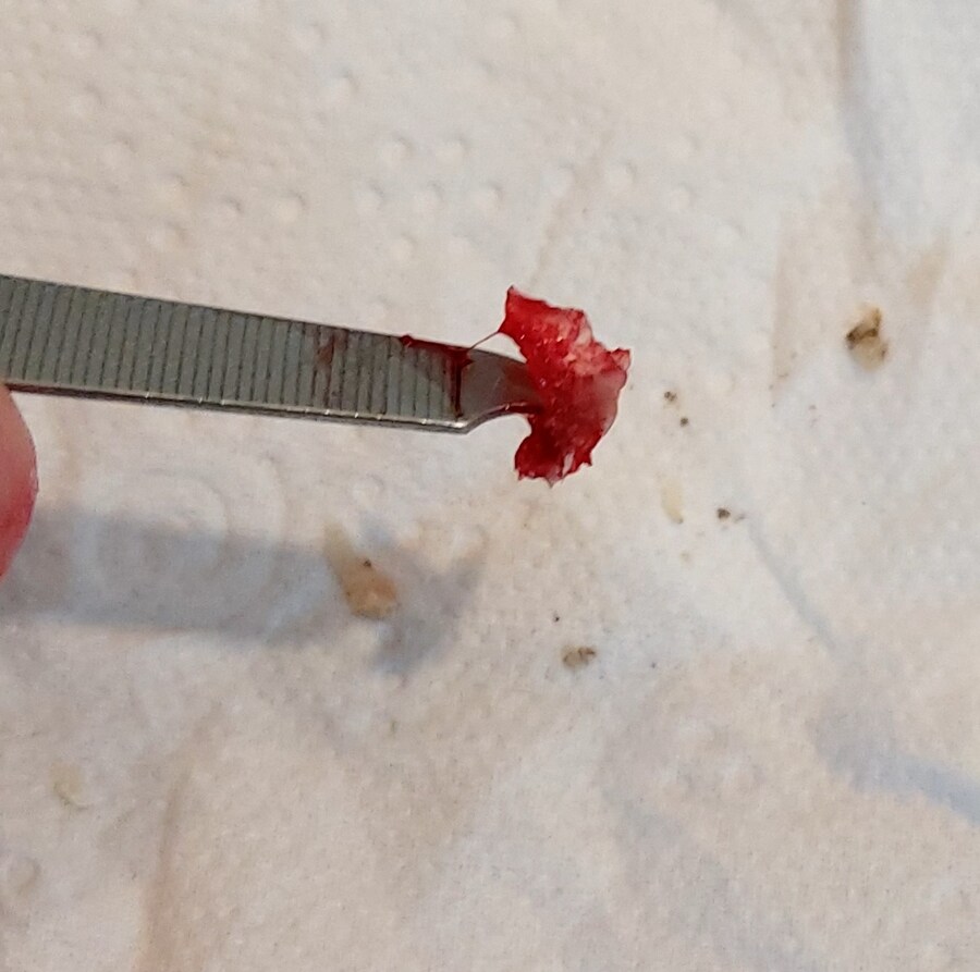 혐) 내성발톱 모음_7.jpg