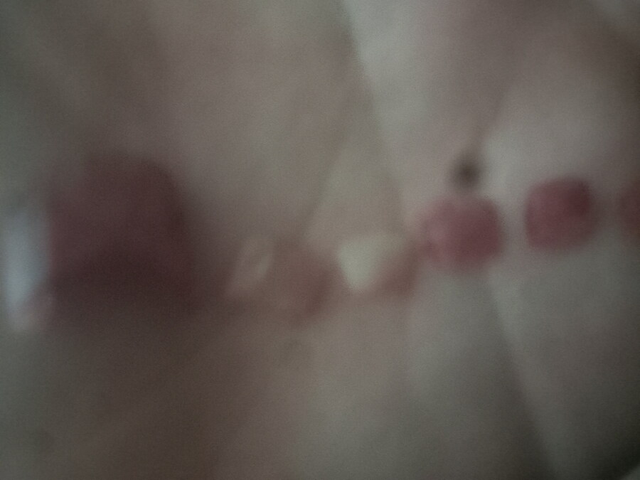 혐) 내성발톱 모음_3.jpg