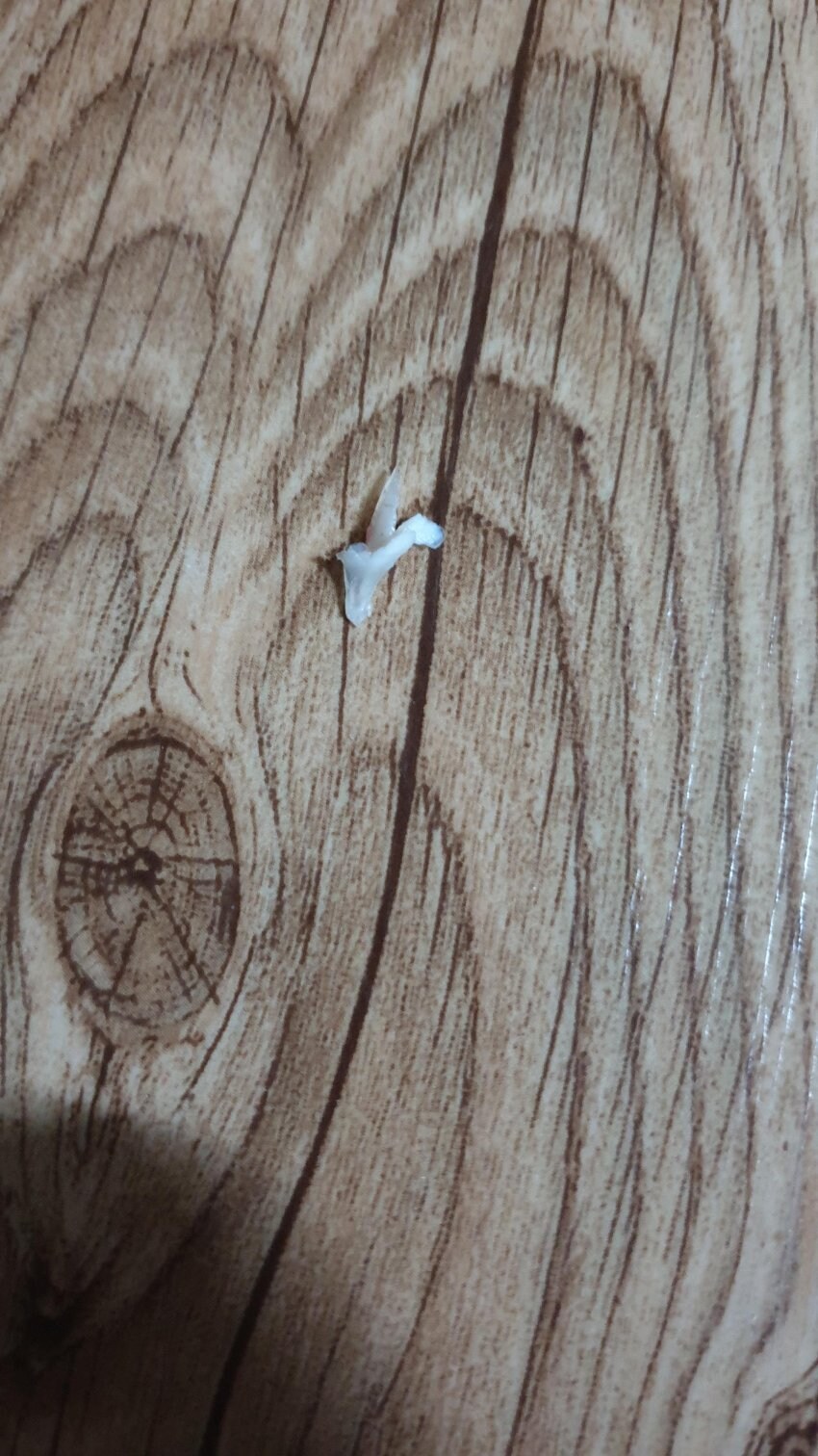 혐) 내성발톱 모음_5.jpg