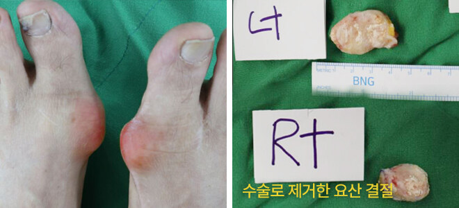 혐) 아프다 아파아아앗_11.jpg