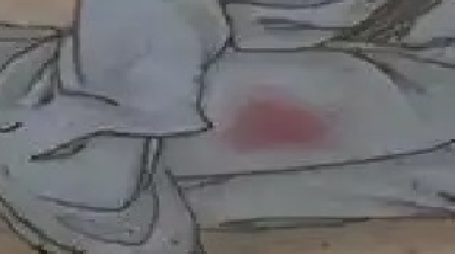 신하가 자기 살을 바쳤더니 태워 죽인 군주_9.jpg