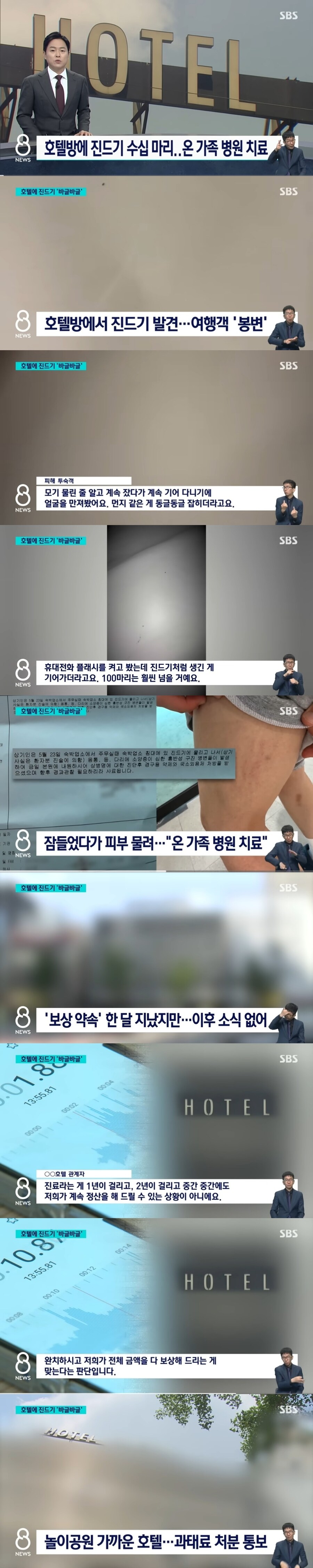 대구 한 호텔서 투숙했다 봉변…불 켜보니 "진드기 100마리"_1.jpg