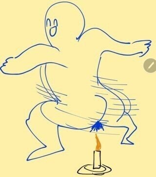 여자 똥꼬털 제모.jpg_3.jpg