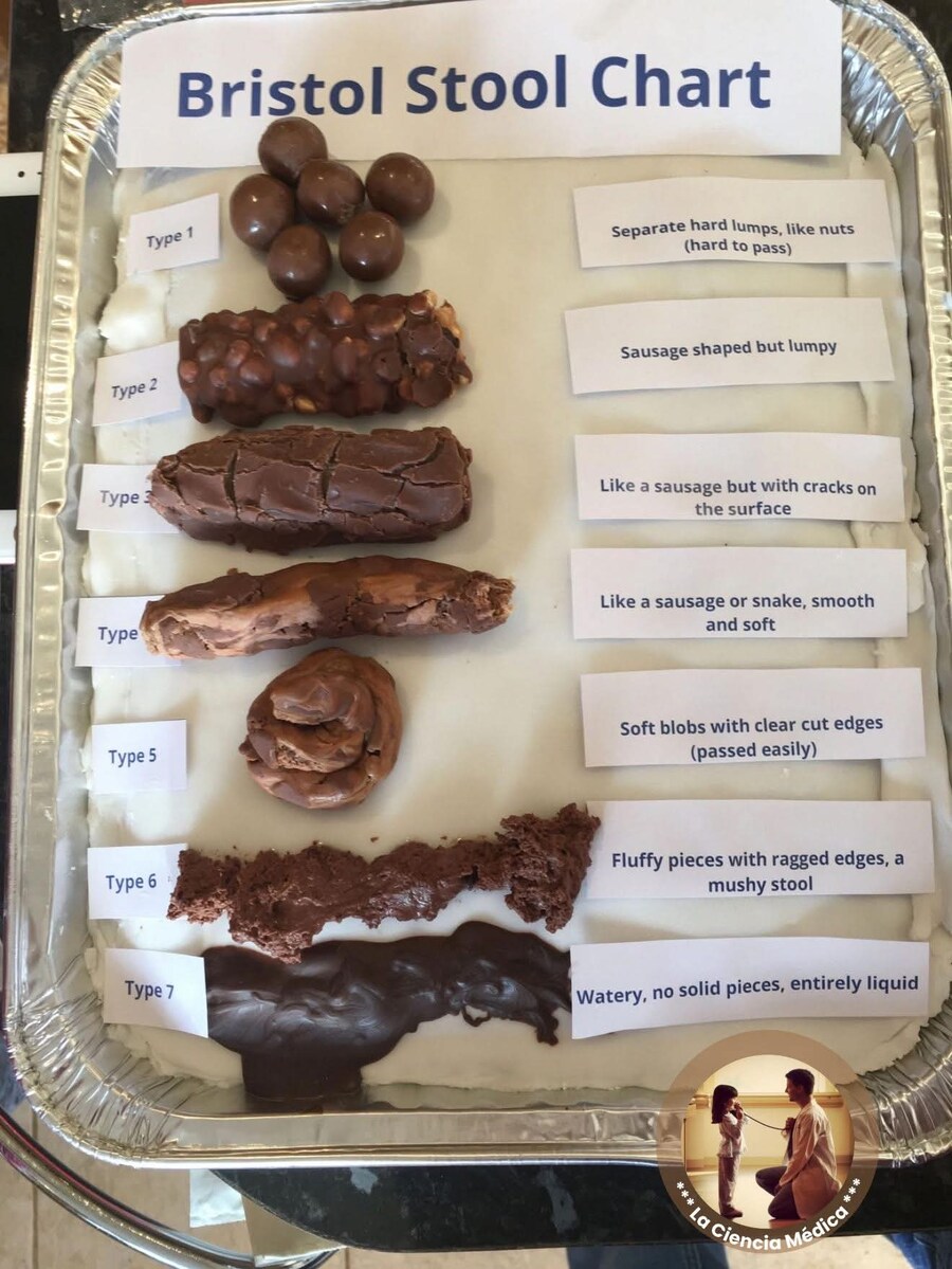 초콜릿으로 쉽게 알아보는 브리스톨 대변 도표_1.jpg