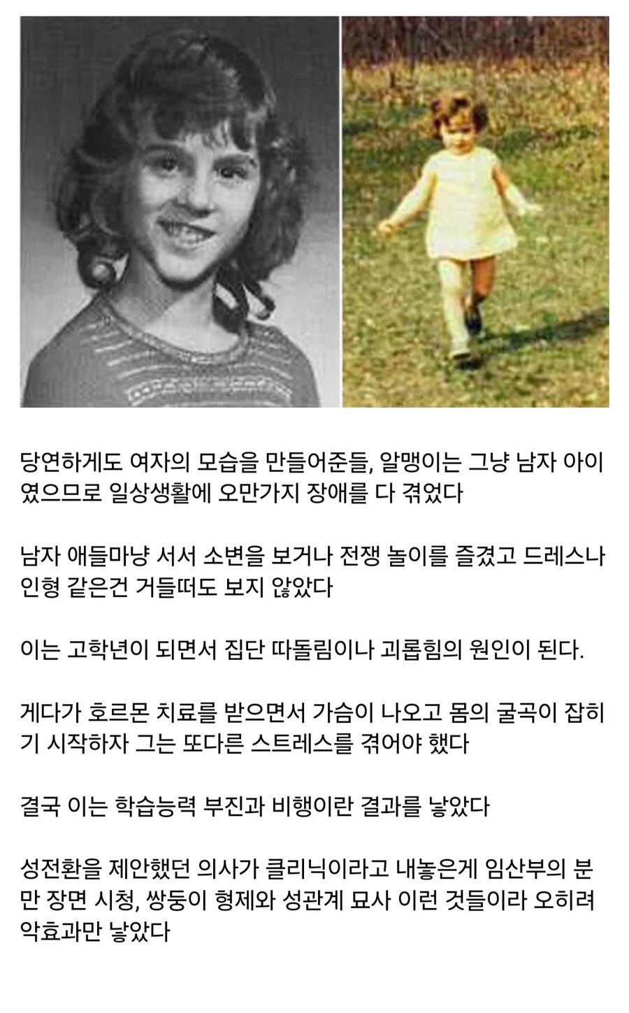 성전환 수술을 두번이나 받은 사나이.jpg_2.jpg
