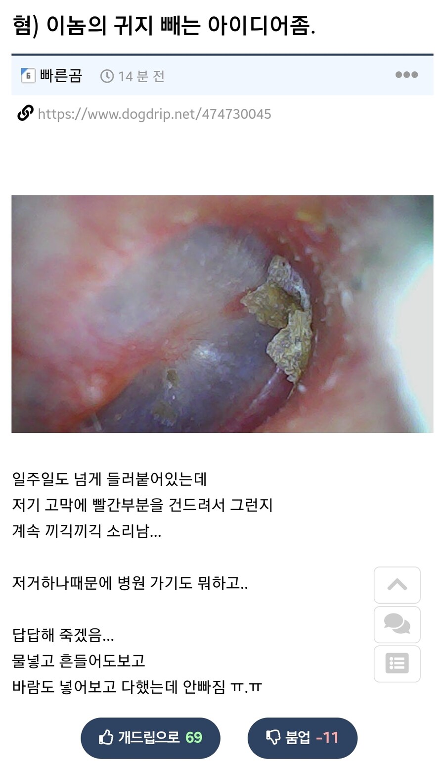 이거하나때문에 병원가기는 그런데..._1.jpg