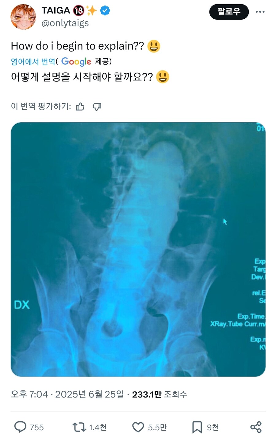 설명하기 어려운 딜도_1.jpg