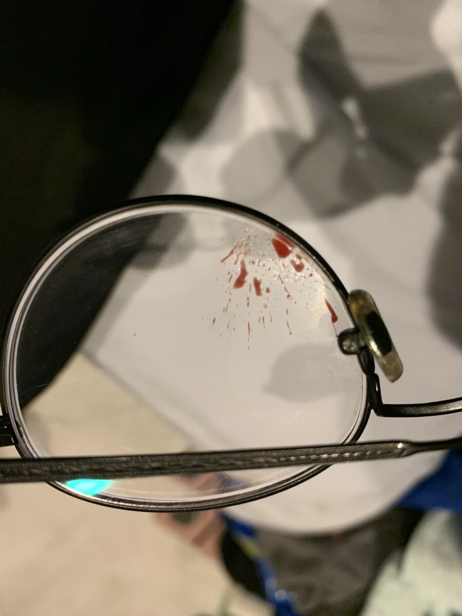 자기 전에 적어보는 거?식?증? 향수?병? 얘기_6.jpg