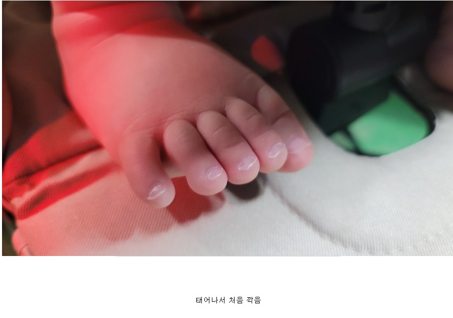 태어나서 한번도 발톱을 안깍은 여자의 발톱 깍은 후기 jpg_1.png