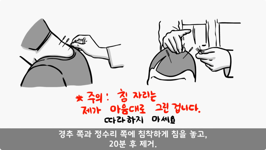 군단장님께 침 놔준 한의사 의무병.jpg_18.jpg