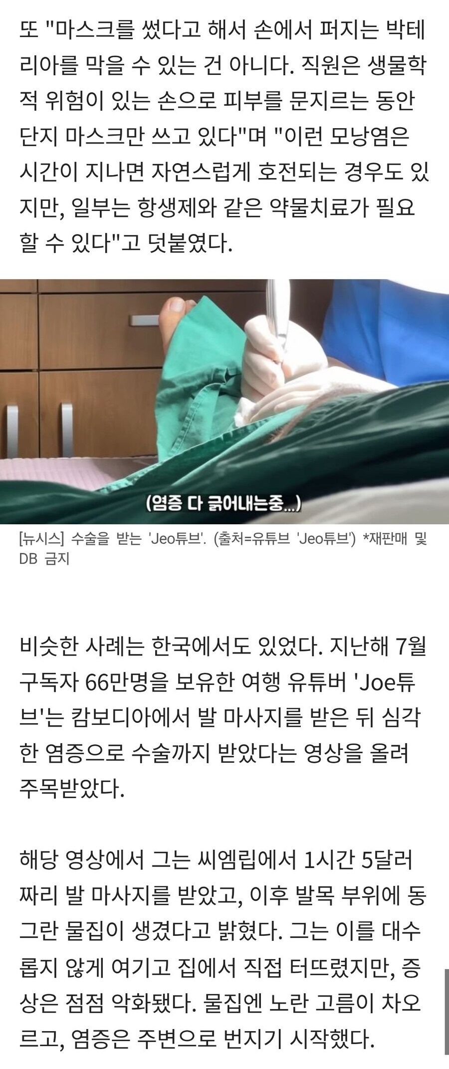 동남아 마사지 받았다가 피부썩어_4.jpg