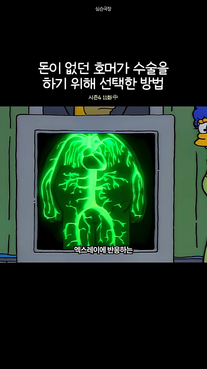 심슨가족]엑스레이에 반응하는 염료를 주사해서..._1.png