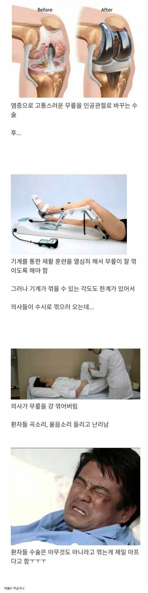인공관절 수술 후, 환자들 최고의 고통_1.webp