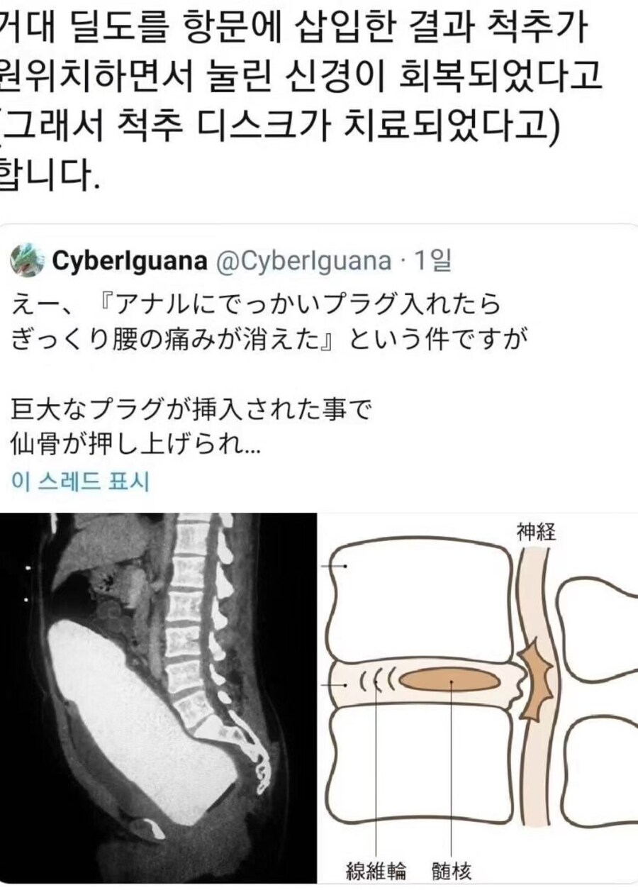 거대 딜도를 항문에 삽입했더니_1.jpg