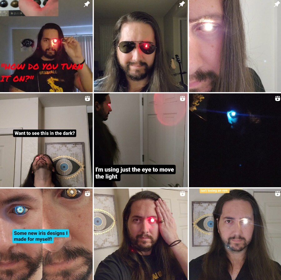 암으로 한쪽 눈을 잃은 남자의 의안_1.png