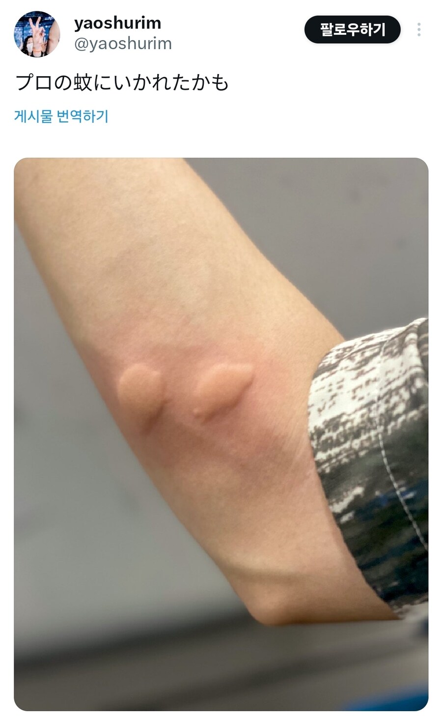 아디다스 모기에게 물린 자국.jpg_1.jpg